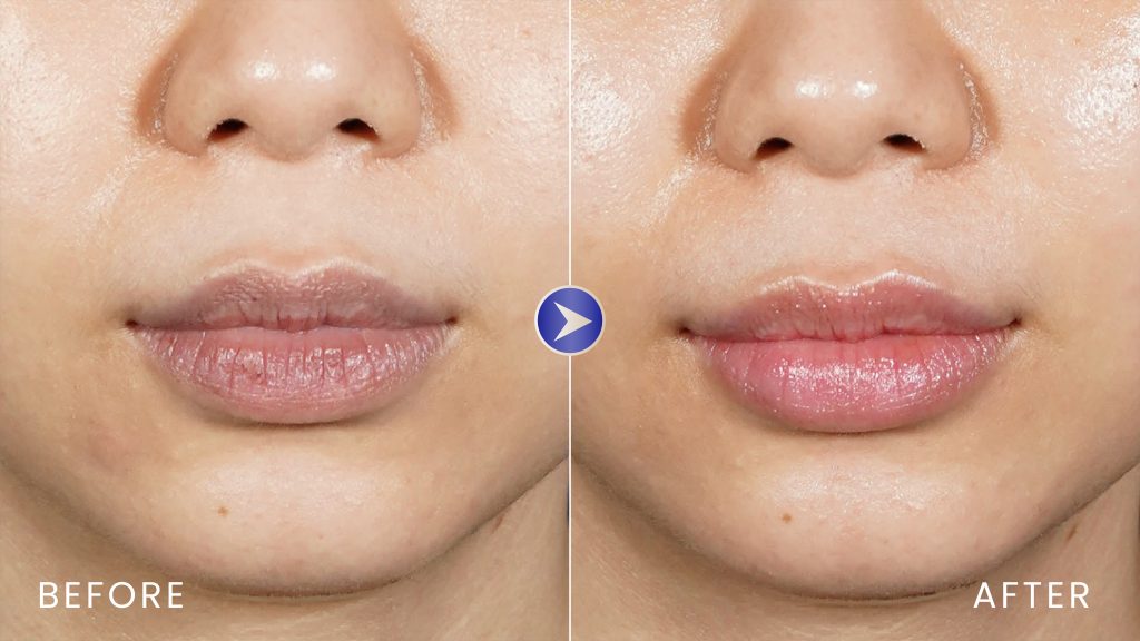 pink lips before after